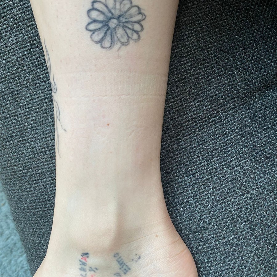 Cover‑Up vom Cover‑Up – Käfer & Blume neu umgesetzt - Vorher