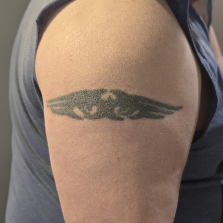 20 Jahre altes Tribal – cleanes Cover‑Up in 2×3h - Vorher